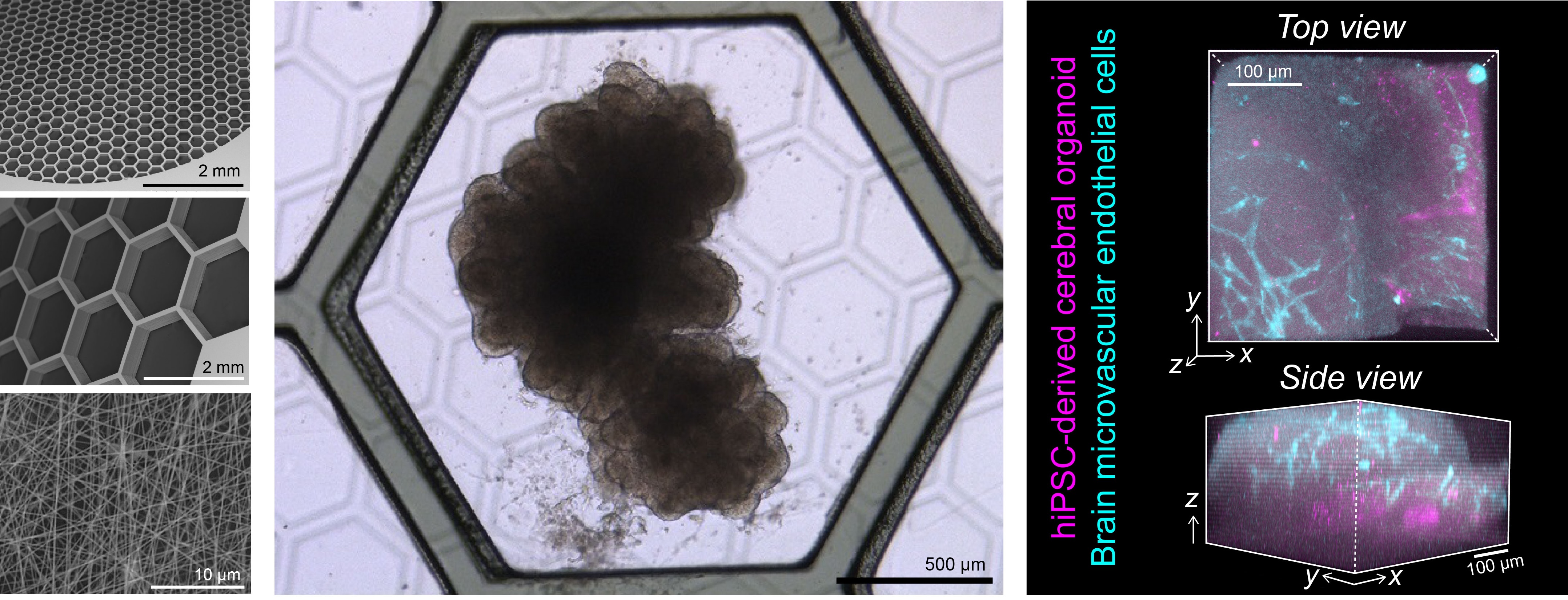 Vascularization of cerebral organoids
